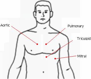 Diagram of male torso showing auscultation points 
